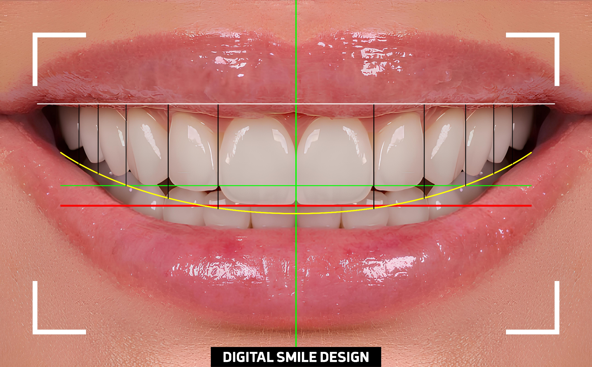 Blog Smile Atlantis Dental | World-Class Dental Tourism